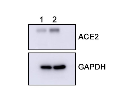Anti ACE2 recombinant antibody - western blot