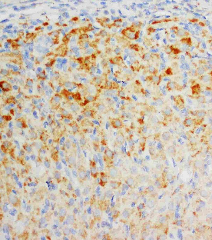 FGF17 helps restore memory in mice