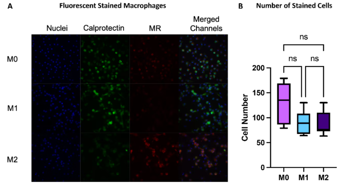 macrophage-stained-cells
