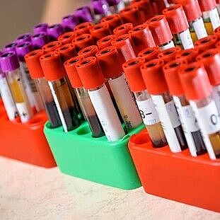 human biofluids lab photo of blood tubes stored for experiment