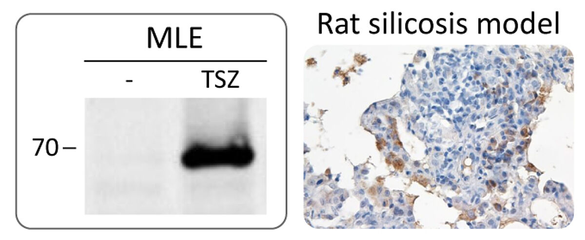 RIP1 pSer166 antibody