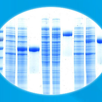 QuickBlue Protein Stain - Better than InstantBlue!