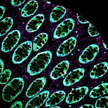 AtlasPlex Multiplex IHC Kit