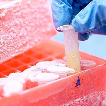 Cryopreservation Media