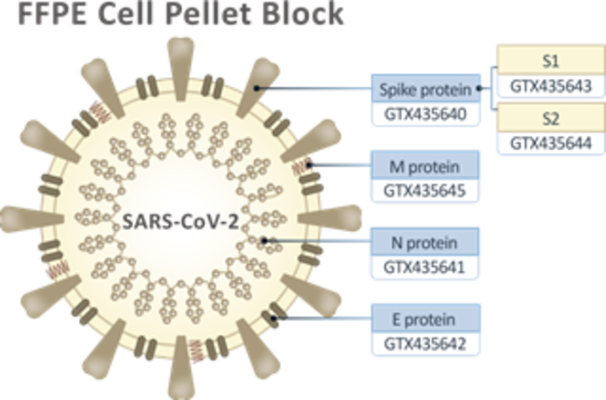 FFPE SARS-CoV-2 cell pellet blocks