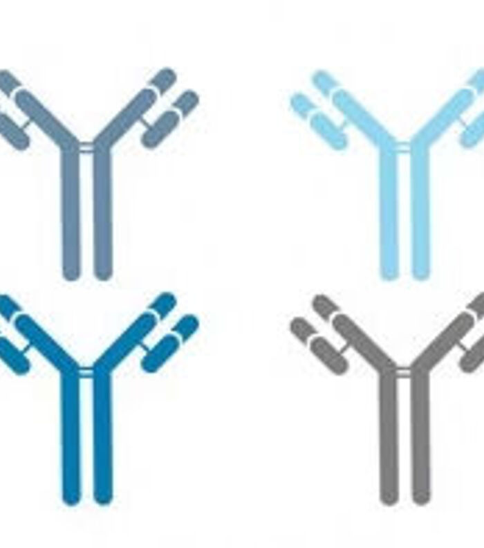 How to Distinguish a Good Antibody from a Bad One