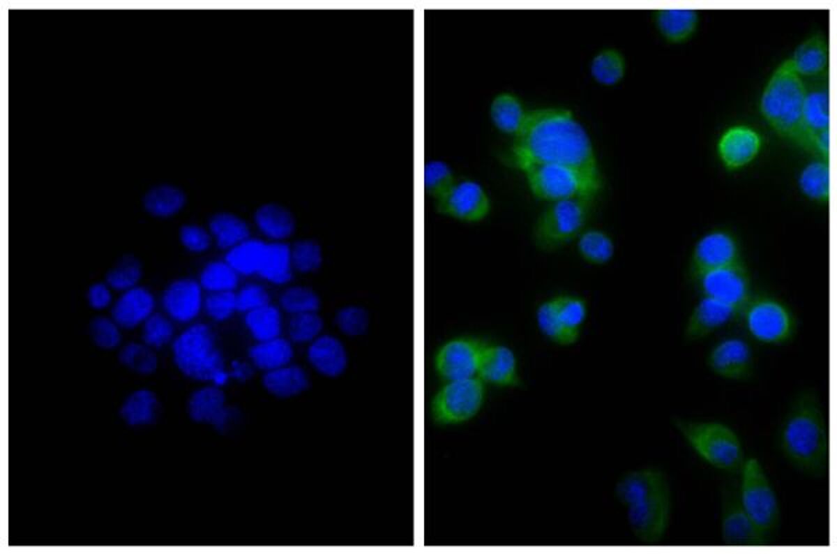 Human pancreatic carcinoma cell line MIA PaCa-2 was stained with Mouse Anti-Cytokeratin 18-UNLB followed by Goat F(ab')2 Anti-Mouse IgG(H+L), Human ads-BIOT, Streptavidin-FITC and DAPI.
