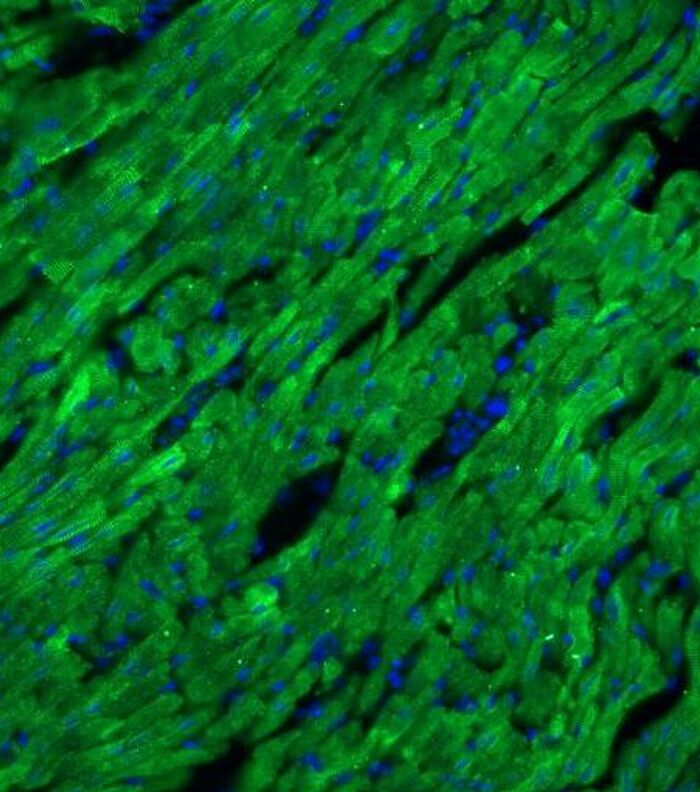 The Heart of the Matter