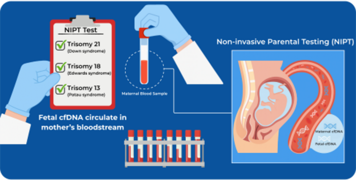 NIPT test schematic