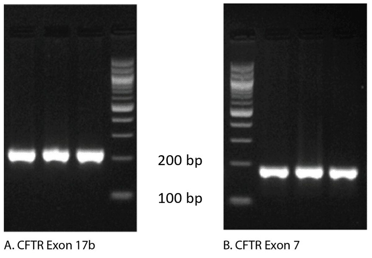 Figure 2. Agarose gel electrophoresis of qPCR products show single amplicons. Analysis of qPCR amplicons on an agarose gel stained with ethidium bromide shows a single band for both (A) exon 17b and (B) exon 7 of the CFTR gene.