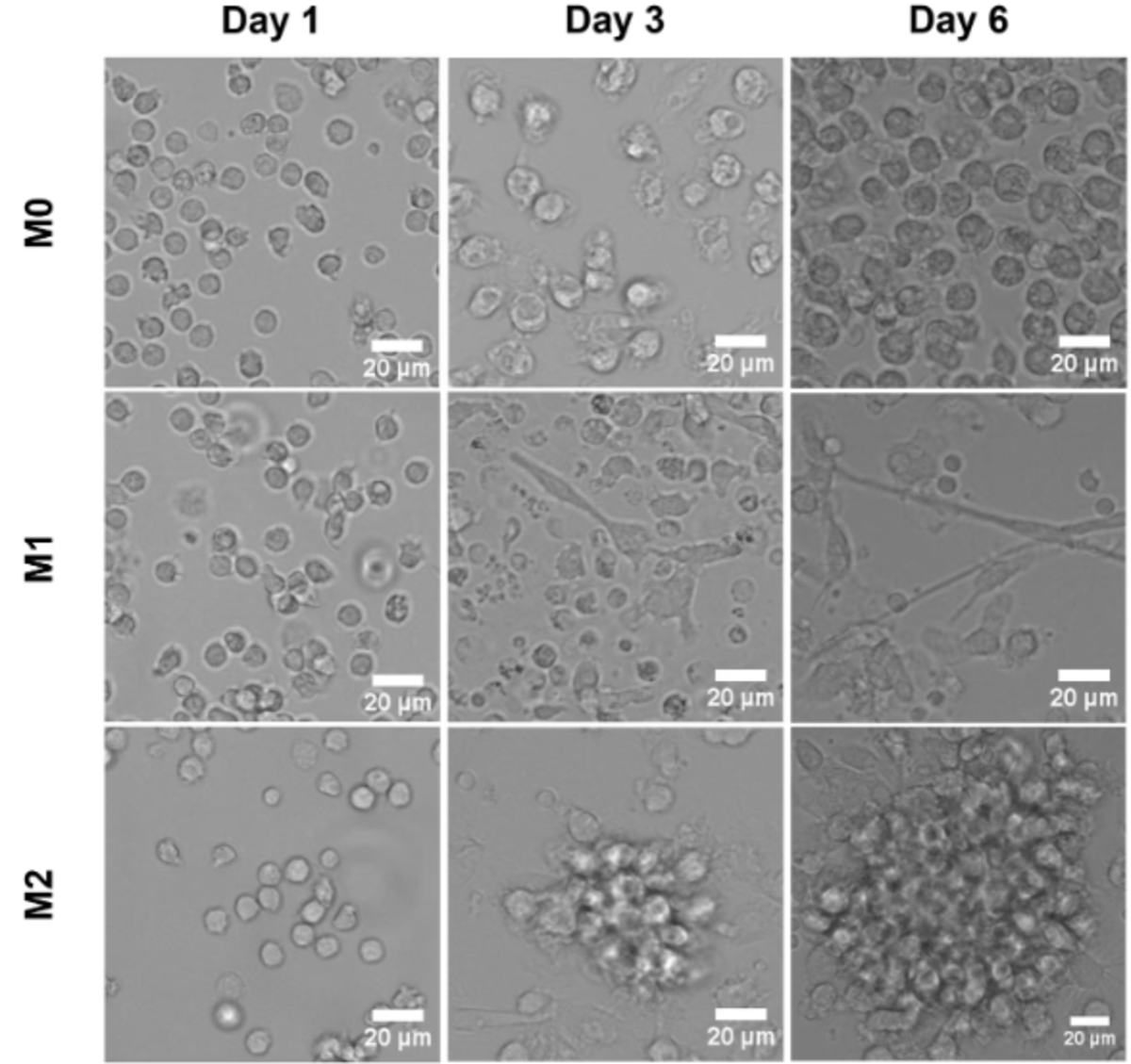 macrophage-monocytes