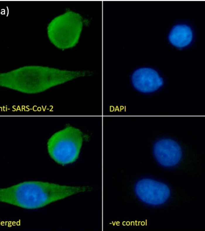 Collaborating on Antibody Match Pair for COVID19 Research