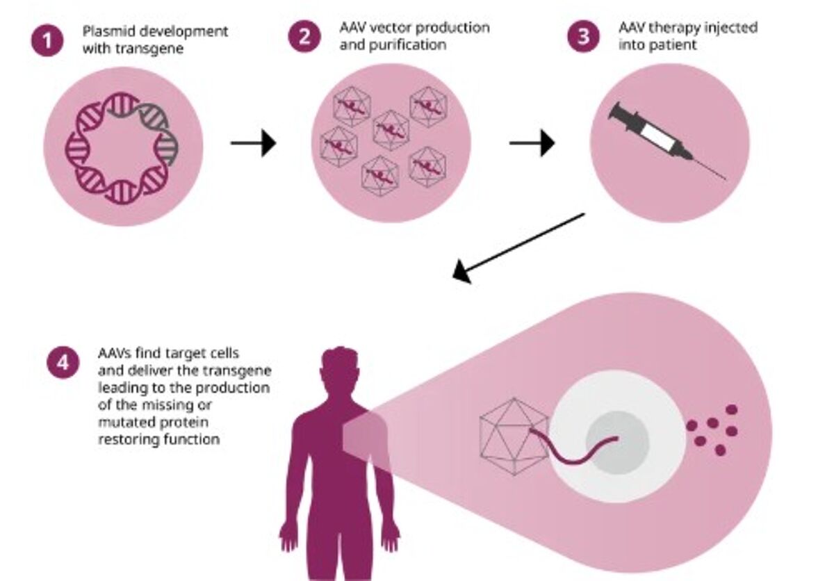 Viral vector-based gene therapies start with the design of a plasmid containing the transgene for the missing or defective gene. The viral vector is manufactured containing the transgene and given to the patient to restore the production of the specific protein and normal function.