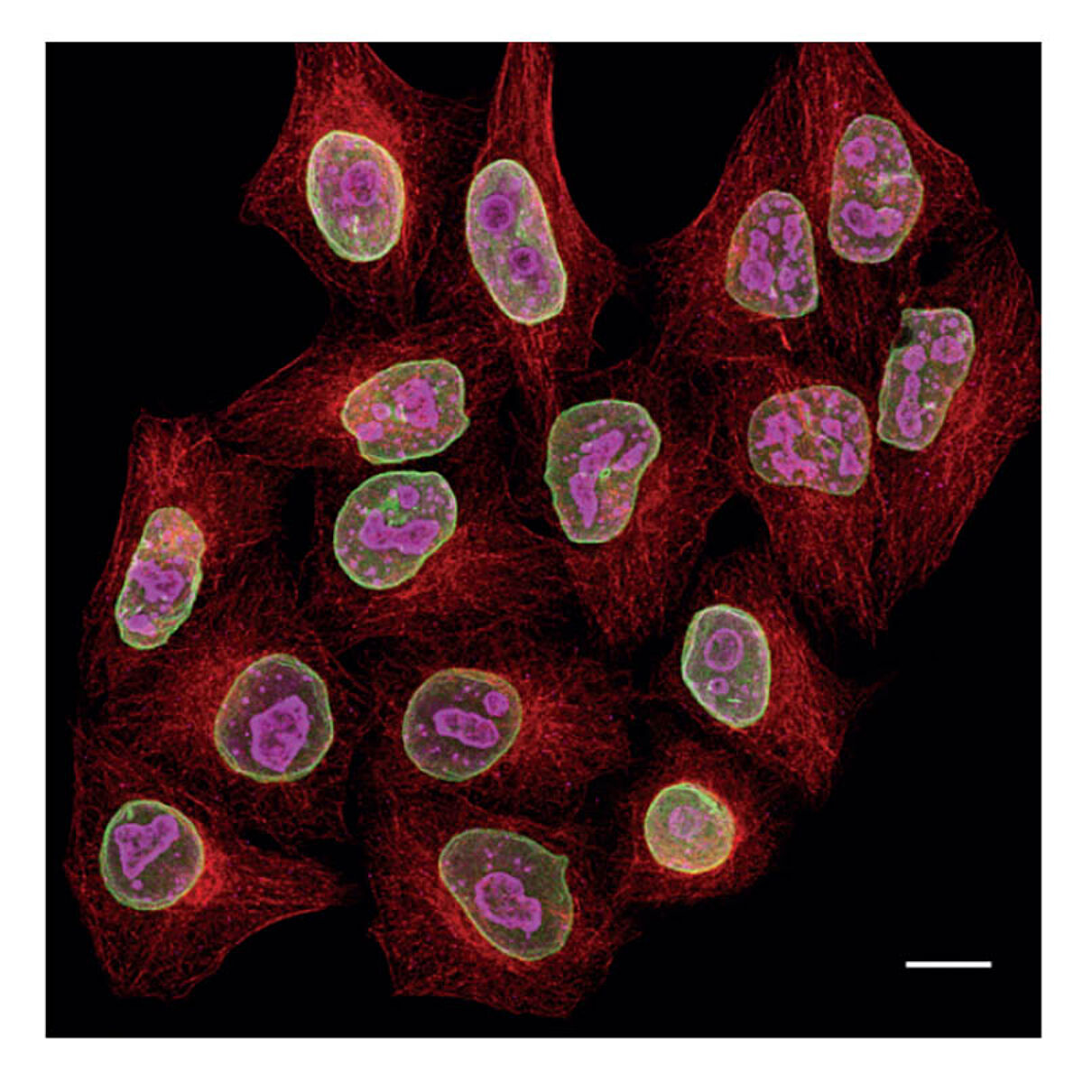 Multiplexing