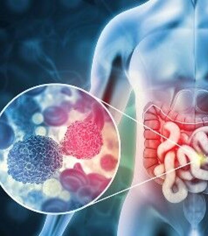 Why Microbiome Standards Matter