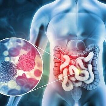 Gut Microbiome Standards