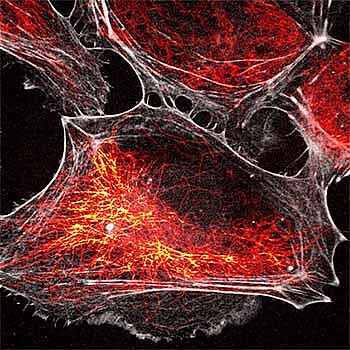 SPY FastAct probes: ultrafast dynamic actin labeling