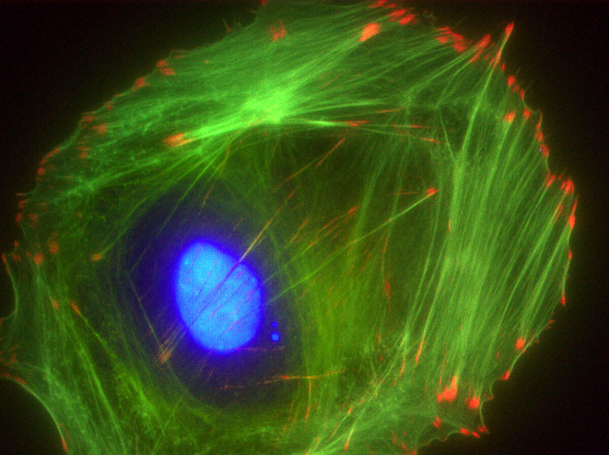 blog-transcriptonomics-Acti-stain488