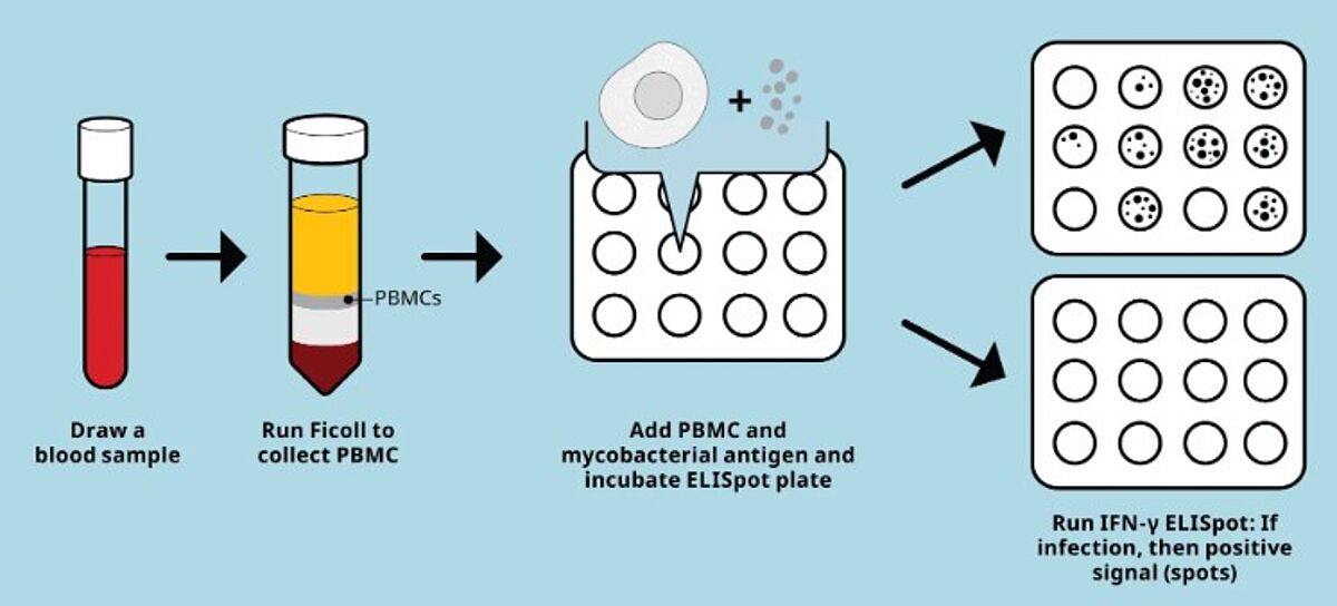 ELISpot TB diagnosis
