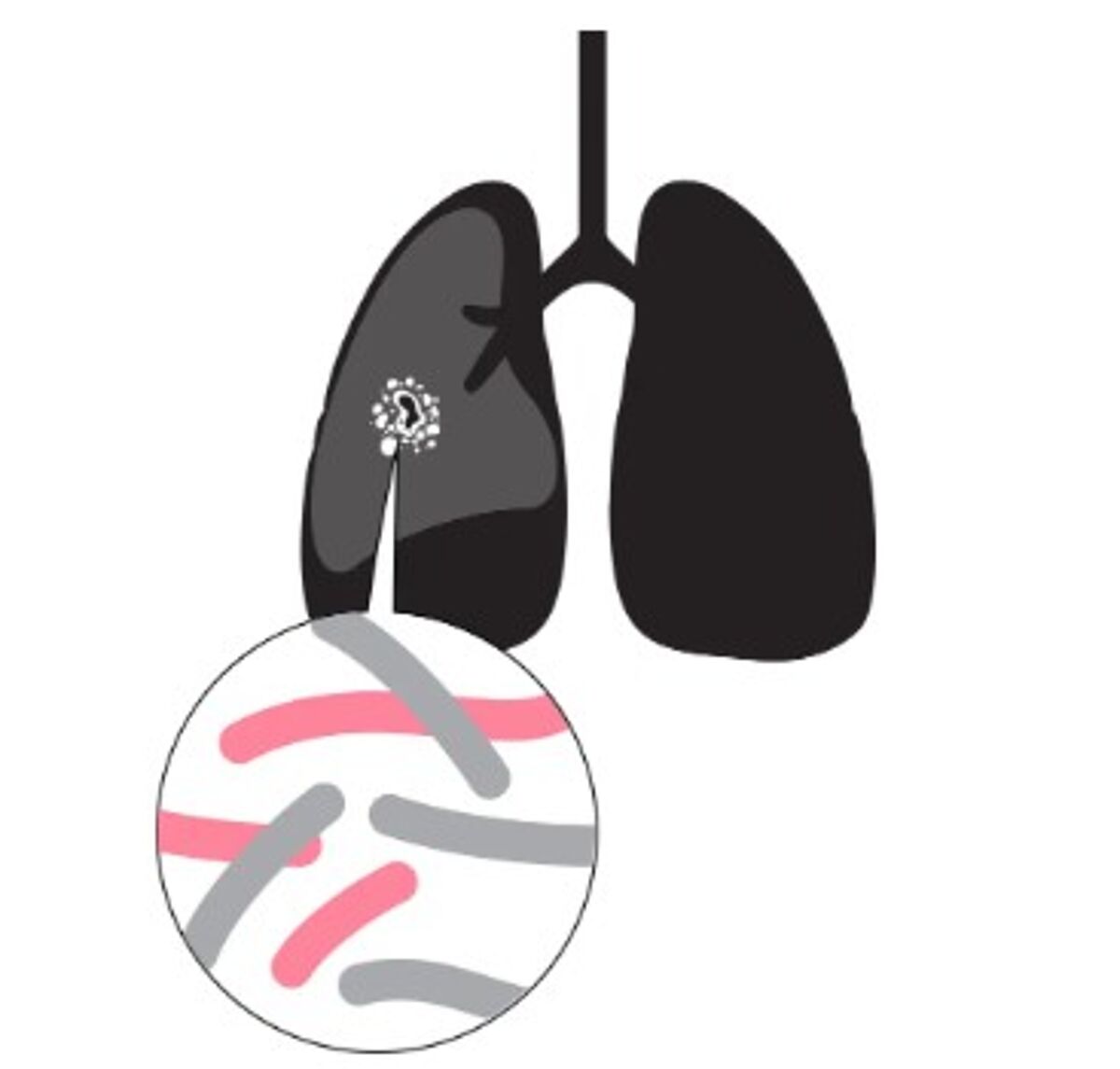 M. tuberculosis hide in lung granulomas