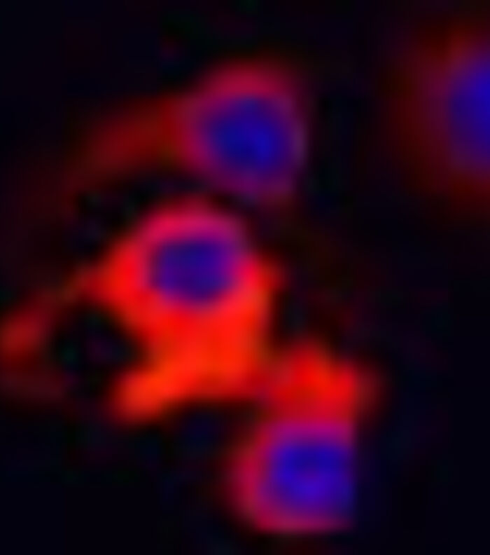 Targeting Cadherin-17