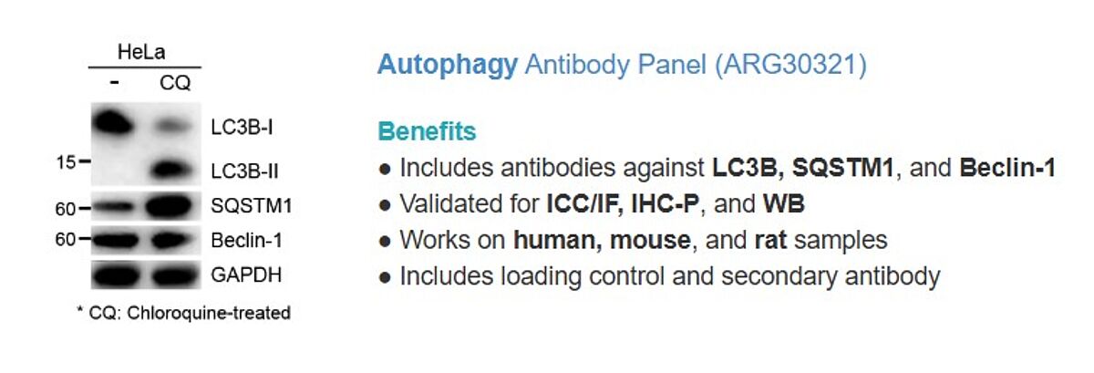 autophagy assay
