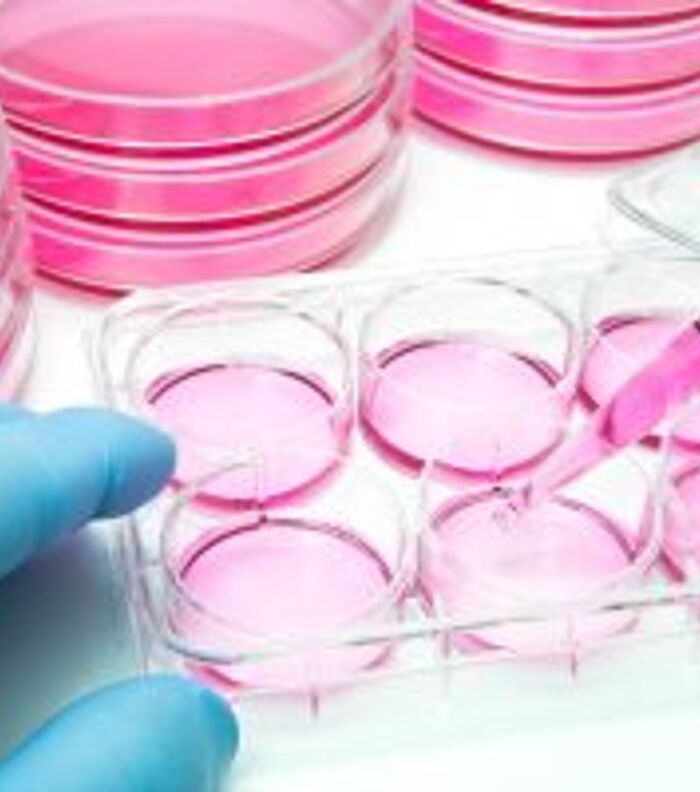 Why InVivo formulation antibodies are a natural fit