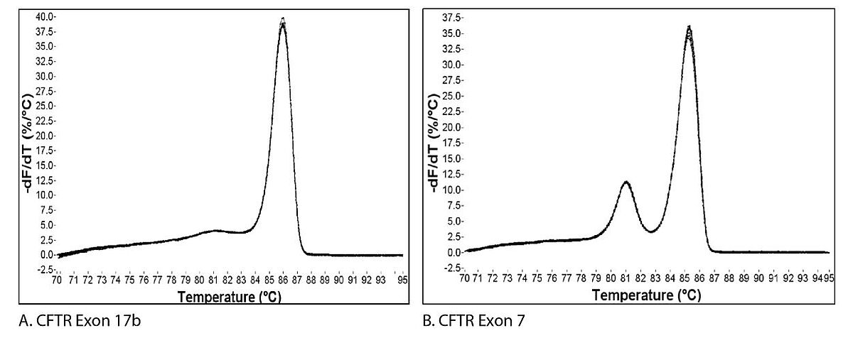 Figure 1. Melt curves from qPCR of CFTR gene. (A) An amplicon from CFTR exon 17b reveals a single peak following melt curve analysis, while (B) an amplicon from exon 7 produces 2 peaks, is often interpreted as representing multiple amplicons, when in this case, there is only one amplicon generated (Figure 2B).
