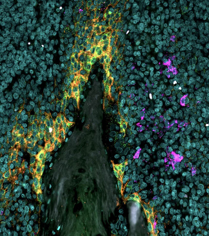 A Beginner’s Guide to Immunofluorescence Microscopy
