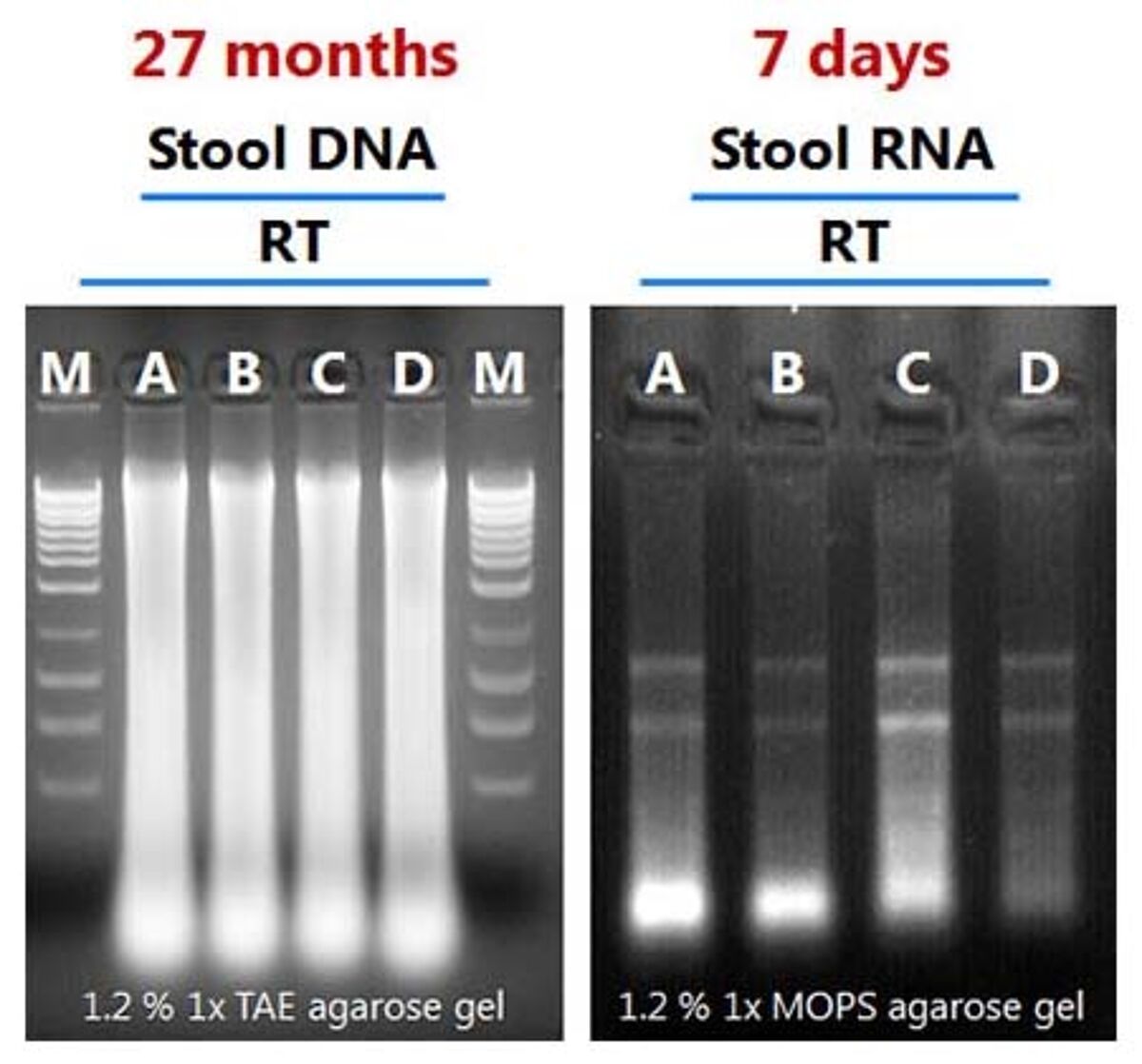 Preservation of high-quality and inhibitor-free DNA/RNA