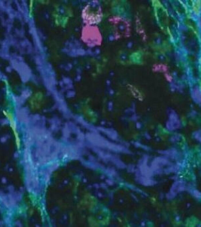 Multiplex Imaging for Oncology