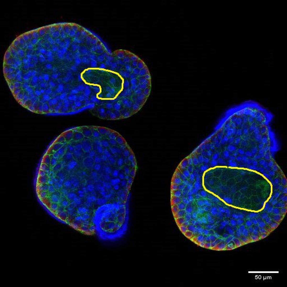 cellbanker cryopreservation of organoics. microscopy image of human lung organoids