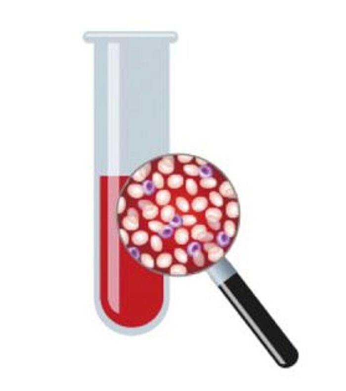 Liquid biopsies in cancer diagnosis and treatment