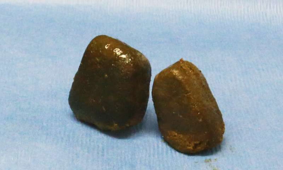 Wombat poop