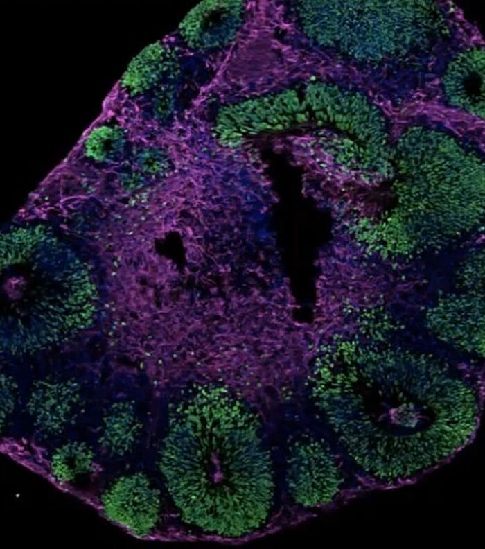 Advancing Organoid Research