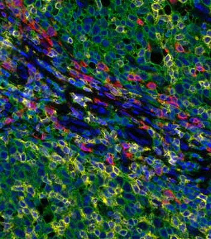 An Introduction to multiplex immunohistochemistry