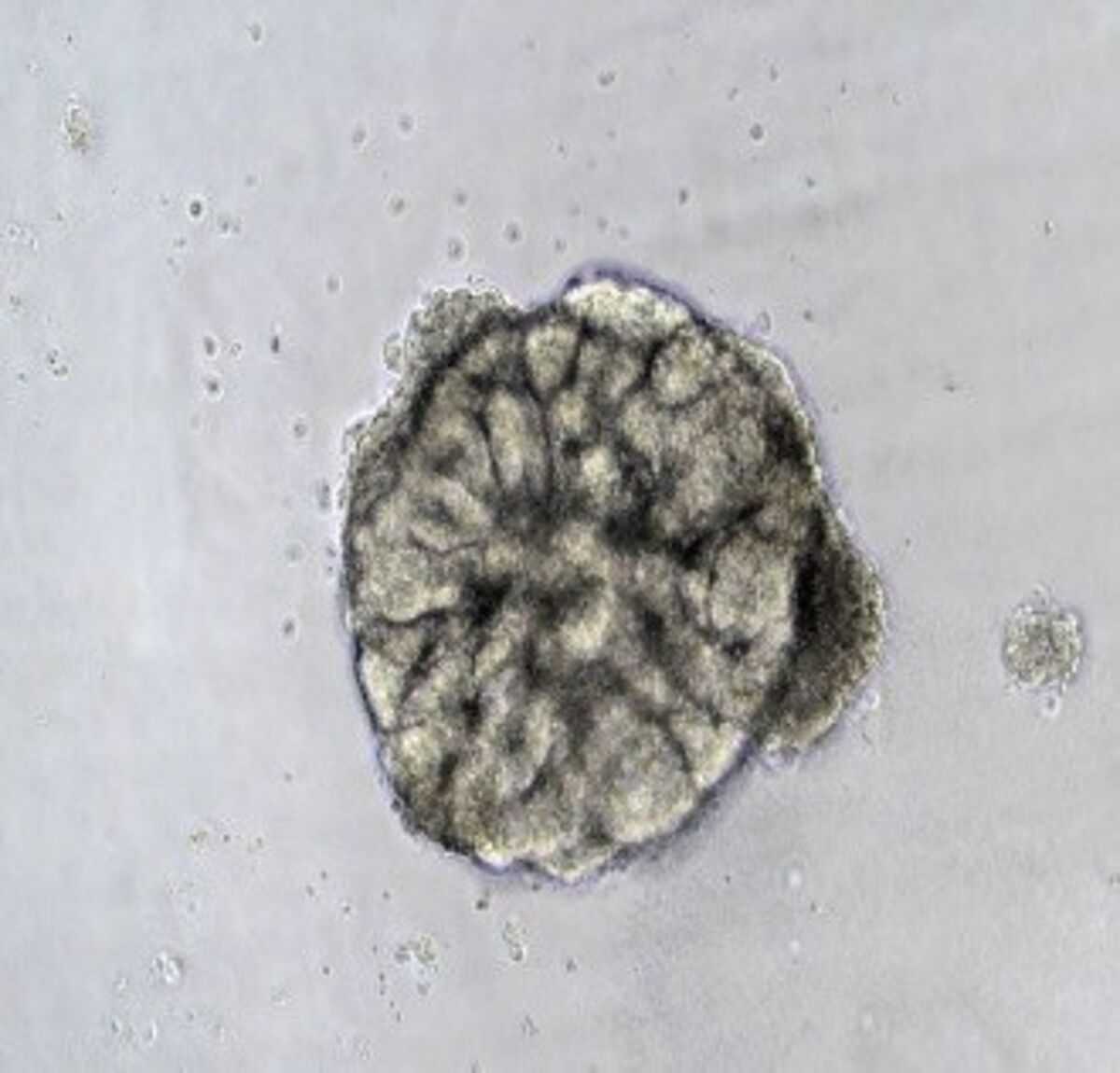Human Kidney Organoid