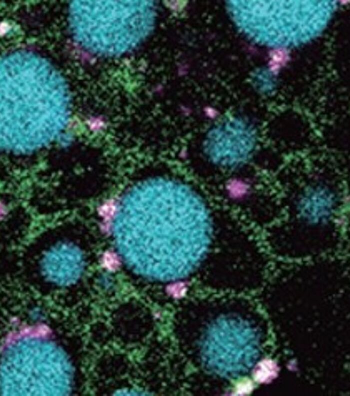 Cancer Vaccines - From Theory to Practice