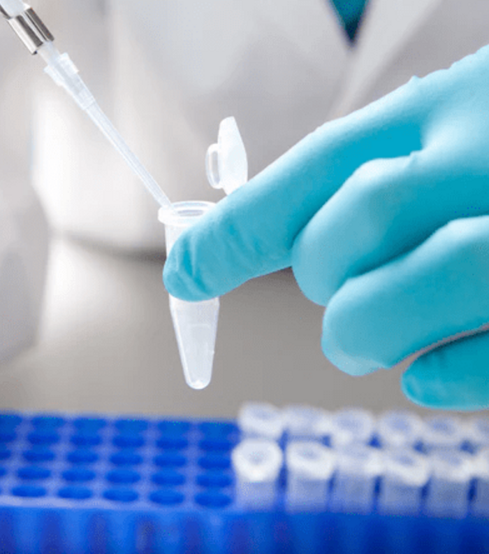 Scaling of RNA Extraction for High Quality and Throughput