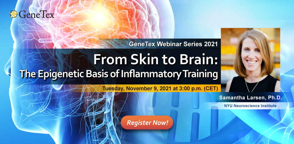 Webinar on the epigenetic basis of inflammatory training