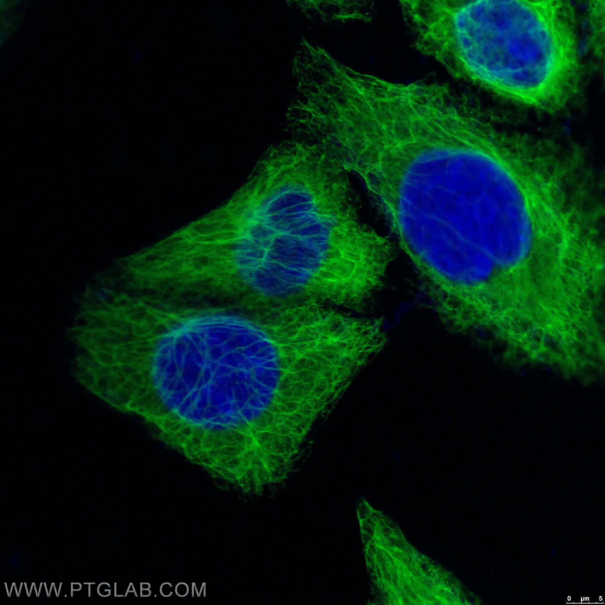 Proteintech anti-cytokeratin-18 IF image