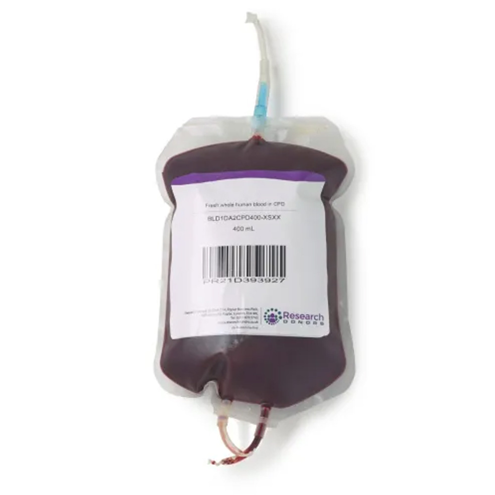 research-donors-portfolio-Whole-blood
